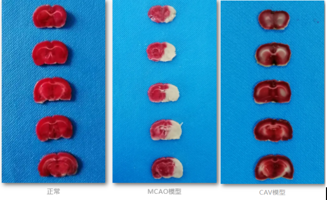 脑缺血及再灌注模型